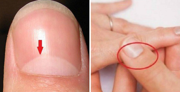 Знаете ли вы что означает полумесяц на ногтях? Ответ намного важнее, чем вы думаете!