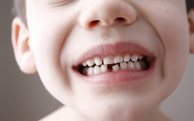 Врачи советуют родителям сохранять зубы их детей. Вот зачем…