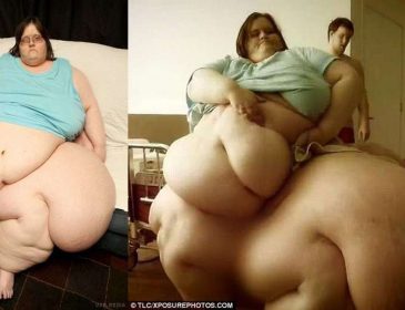 Самая полная женщина в мире похудела на 200 кг: впечатляющие фото