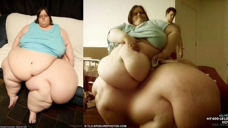 Самая полная женщина в мире похудела на 200 кг: впечатляющие фото